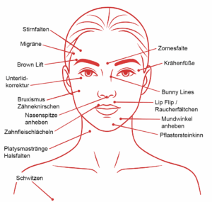 Gesichtsschema für Botox und Hyaluronsäure Behandlungen