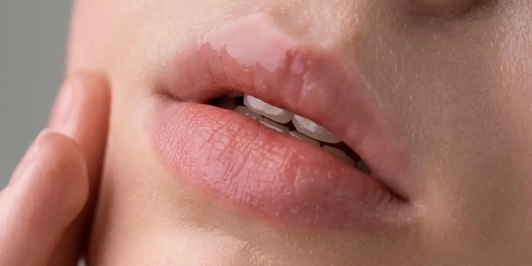 Hängende Mundwinkel